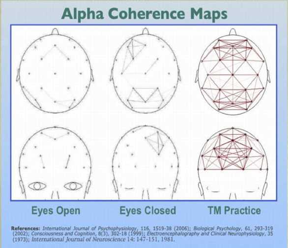 47_Bevan.jpg - This chart of alpha coherence maps, prepared from charts that appeared in several reputable journals, shows a definitive increase in coherent brain wave activity during Transcendental Meditation, as compared to sitting with eyes open and sitting with eyes closed.